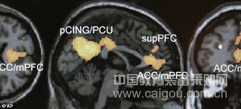 大脑扫描实验证实能看到人们所想事物